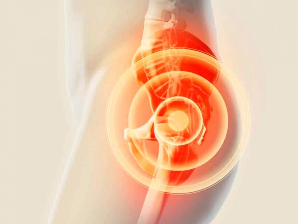 neuralgia-do-pudendo-logo-comigo