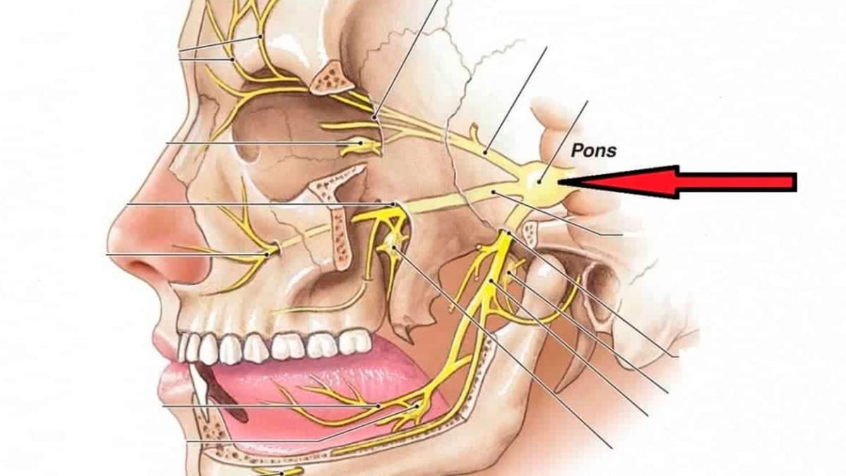 Nevralgia do Trigêmeo - Uma Grande Dor de Cabeça