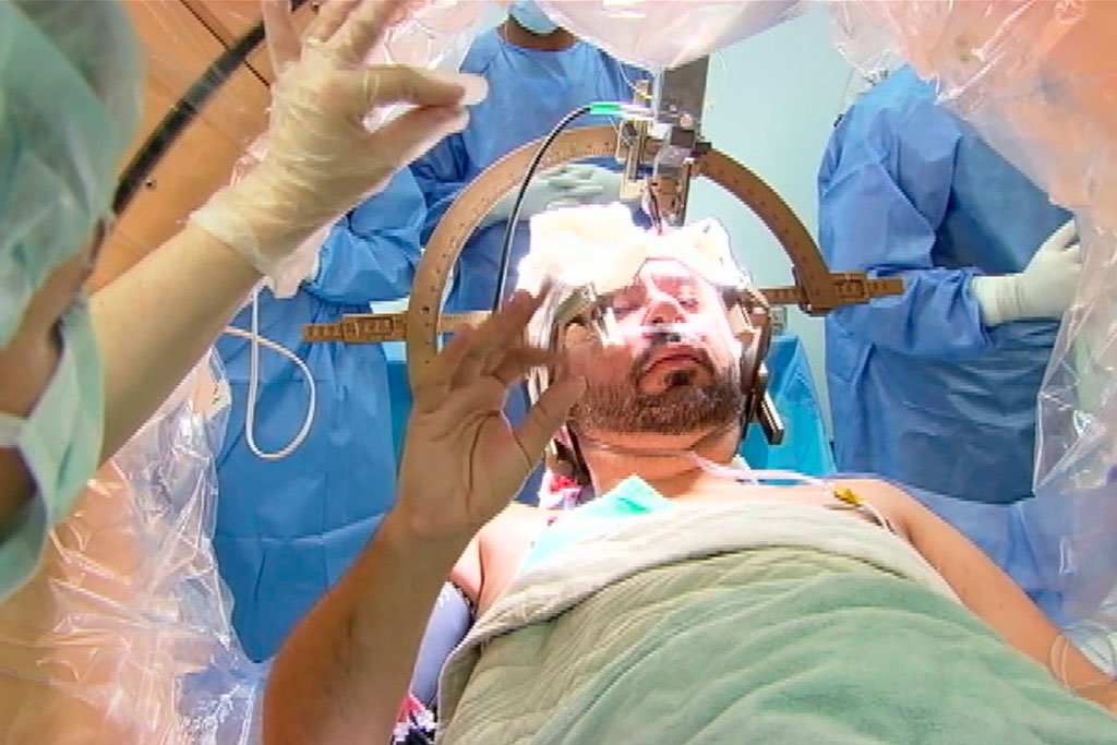 Fotografia de neurologista realizando a cirurgia de Parkinson