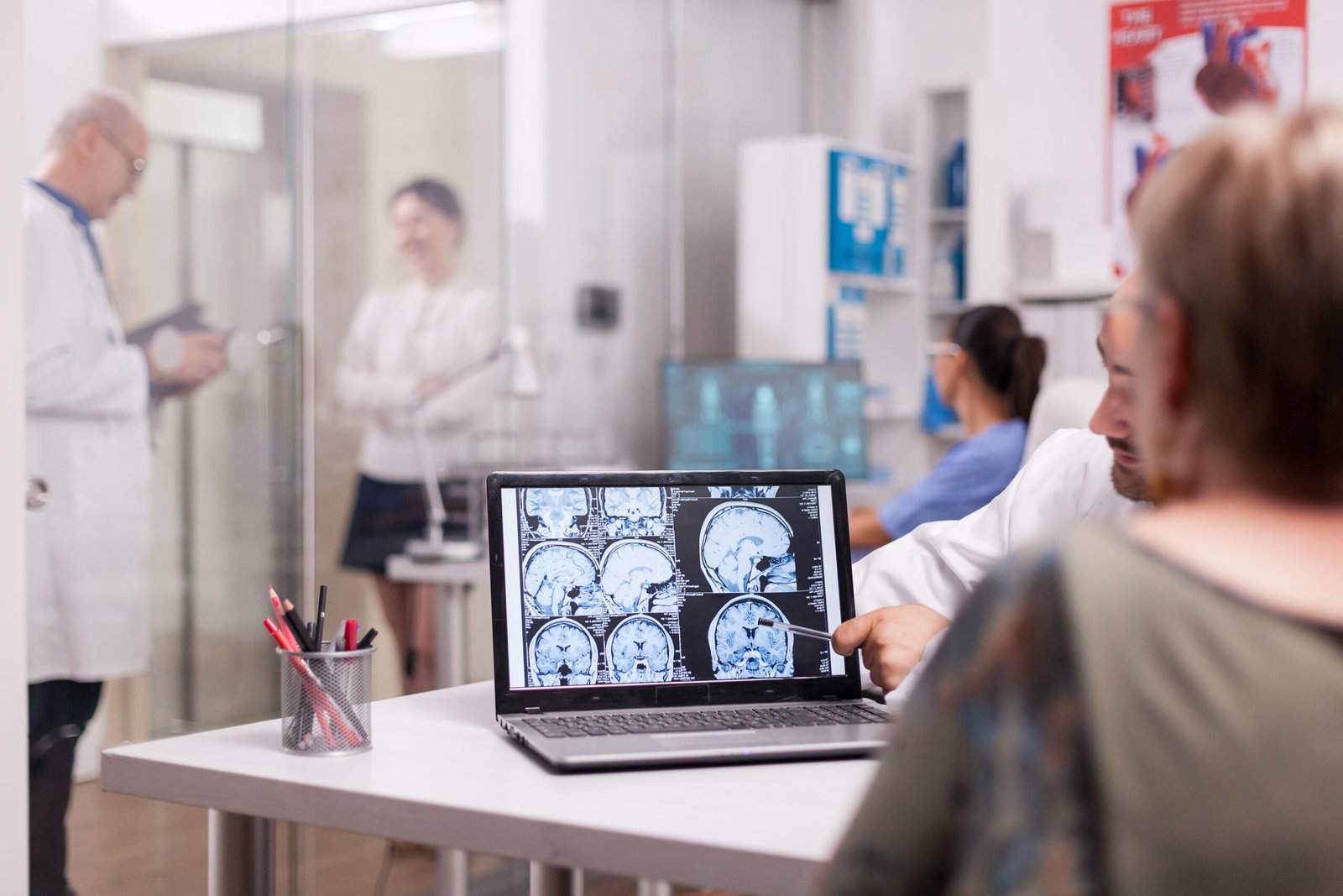 Imagem de neurologista mostrando exames de imagens do seu cérebro, certificando-se há ou não epilepsia.