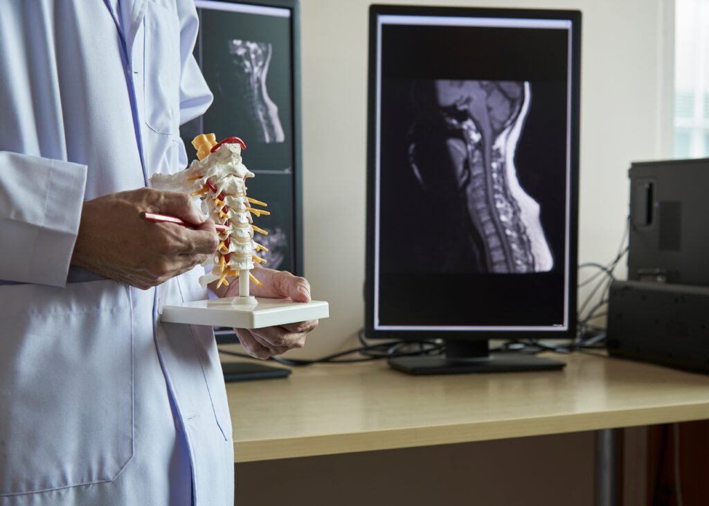 Fotografia de médico neurologista com exames da coluna ao fundo. Ele está segurando um protótipo da coluna.